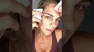 How to correctly pop a pimple | tips, tools & tutorial for popping pimples without making them worse