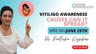 Vitiligo Awareness: What causes it? | सफेद दाग क्या है? |
