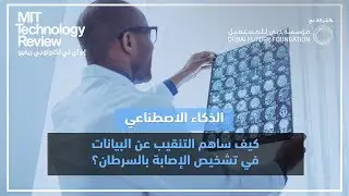 كيف ساهم التنقيب عن البيانات في تشخيص الإصابة بالسرطان؟