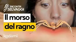 Ragno violino, la tecnica del morso: il suo veleno è davvero così letale?
