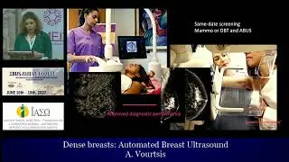 AUTOMATED BREAST ULTRASOUND Dr A VOURTSIS