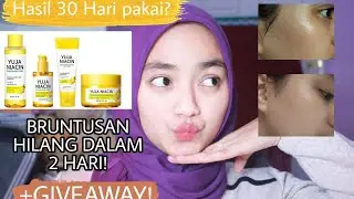 SOMEBYMI YUJA NIACIN STARTER KIT REVIEW