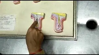 Devlopment of testis
