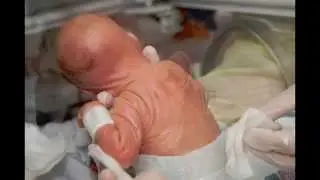 En korkunc hastalıklar. Hassas insanlar izlemesin!