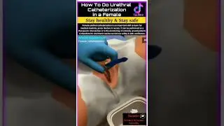 Urethral Catherization in female | Drk