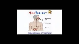 NASOGASTRIC(NG) TUBE INSERTION🩺|VIVA AND POST ENCOUNTER QUESTIONS |LECTURE VIDEO PART 1 |OSCE GUIDE
