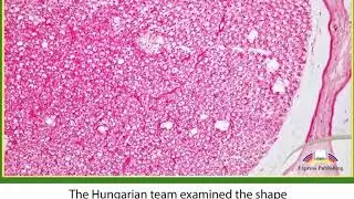 Action 11. Module 3. The Rosehip Neurone - A New Type of Brain Cell