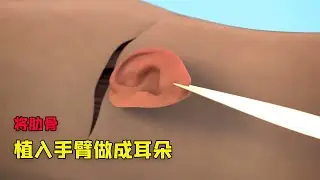 如果你的耳朵被切了下来