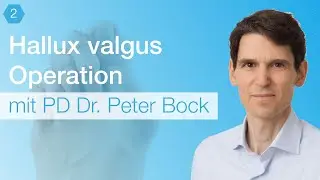 Hallux valgus surgery | Expert talk | things you should know about