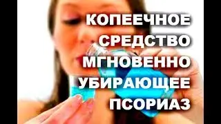 КОПЕЕЧНОЕ СРЕДСТВО ,его  ПСОРИАЗ БОИТСЯ БОЛЬШЕ ВСЕГО, ВОЗЬМИТЕ ОБЫЧНЫЙ/  псориаз лечение  #здоровье