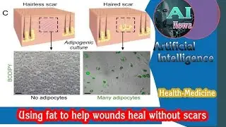 AI - Using Fat to Help Wounds Heal Without Scars