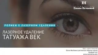 Лазерное удаление татуажа век. 