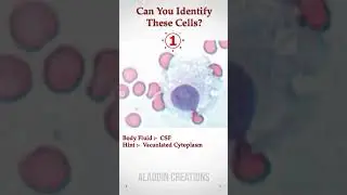 Can you identify these Cells In Body Fluid ? 🧐🙄🤔 