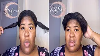 DEPRESSION + PREGNANCY CAUSED ME TO LOSS MY HAIR 😭