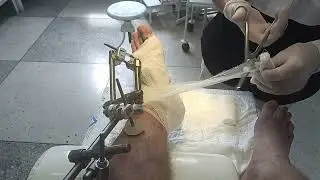 Больничные будни: перевязка