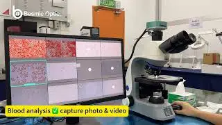 OPTIMOS OPEX 33T BIOLOGICAL MICROSCOPE - LIVE BLOOD ANALYSIS