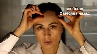 Выпадение волос / аптечная косметика Польша