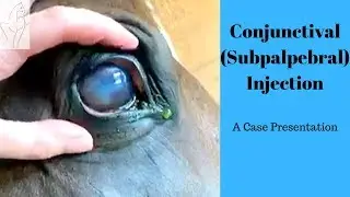 Conjunctival (Subpalpebral) Injection- A Live Case Presentation