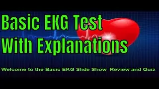 Basic EKG Strip Quiz With Explanations 720p