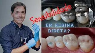 Trocar amálgama sem Sensibilidade com materiais de última geração - Classe I e II Vittra e Ambar APS