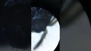 Sleeping Spider under the microscope#lexblags