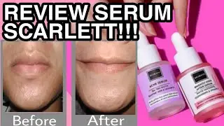 REVIEW SERUM SCARLETT | HASILNYA GINI AMAT YAA...