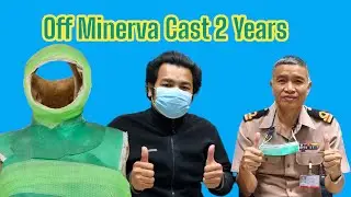 Case Fx. C-spine after take off Minerva Cast 2 years