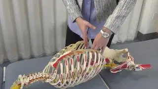 An Osteopathic Approach to Rib Somatic Dysfunction