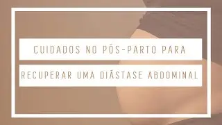 Cuidados no Pós-Parto Para Recuperar Uma Diástase Abdominal | Cirurgia Plástica | Dr Leandro Gontijo