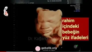 Rahim içinde bebeğin suratını ekşitmesi ve diğer yüz mimikleri, 28. gebelik haftası, 4D ultrason