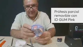 Prótesis parcial removible con ID Gum Pink
