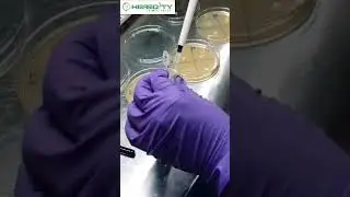Agar well diffusion method 