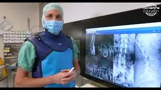 Advanced Techniques in Full-Endoscopic Decompression by Prof. Dr. Christoph Siepe
