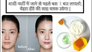 शादी-पार्टी में जाने से पहले बस 1 बार लगालो, चेहरा हीरे की तरह चमक उठेगा |  Glowing skin face mask !
