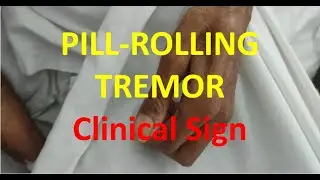 Pill Rolling Resting Tremor | Parkinson Disease