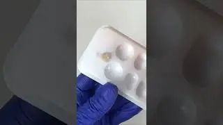 Cimentação de onlay. Passo a passo completo no canal. #estudantedeodonto
