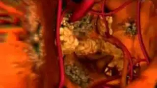 Береги себя. Печень.mp4