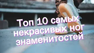 Топ 10 самых некрасивых ног знаменитостей