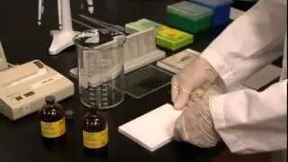 How to run great 2D Gels