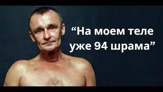 30 лет борется с раком. Петр Погон - человек с одним легким