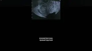 #дгпж #узи  #армдиассистент