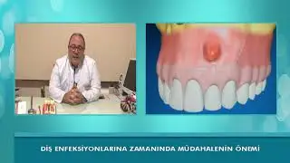 Diş Enfeksiyonlarına Zamanında Müdahelenin Önemi