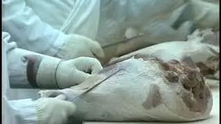 Éclairage