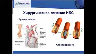АнгиОмега комплекс для защиты сердца