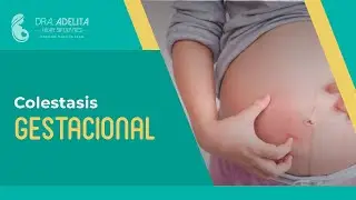 Colestasis gestacional