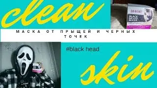 Давим прыщи? Бюджетное средство от прыщей и черных точек.