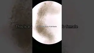 White blood cells in urine seen on patient with recurrent UTI 