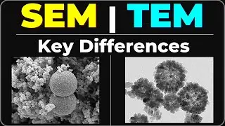 SEM Vs TEM