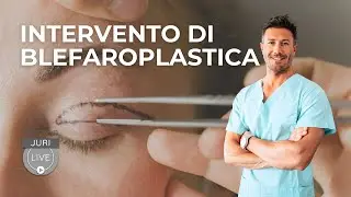 Blefaroplastica