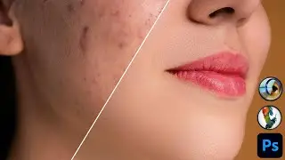 প্রফেশনাল ফটো রিটাচিং সবচাইতে সহজে  | Skin Retouching Photoshop Tutorial Bangla | Face Retouching